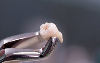A closeup of a pulled tooth held in forceps